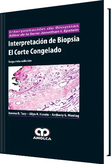 Interpretación de Biopsia el Corte Congelado 2 edición