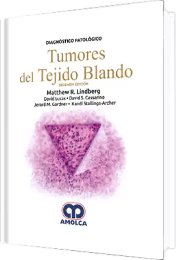 Diagnóstico Patológico. Tumores del Tejido Blando 2 edición