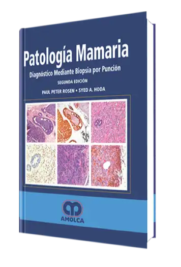 Patología Mamaria. Diagnóstico Mediante Biopsia por Punción 2 edición