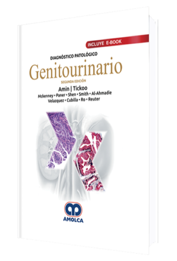 Diagnóstico Patológico Genitourinario. 2 Edición