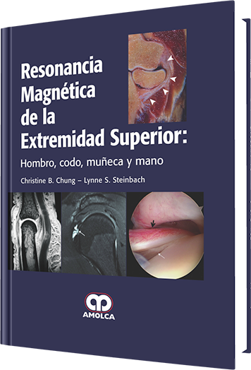 Resonancia Magnética de la Extremidad Superior
