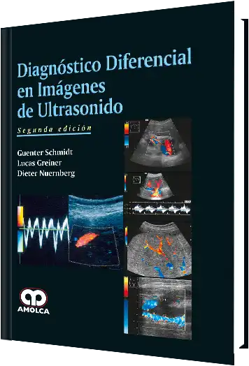 Diagnóstico Diferencial en Imágenes de Ultrasonido. 2 edición