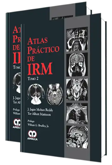 Atlas Práctico de IRM