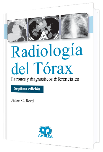 Radiología del Tórax. Patrones y Diagnósticos Diferenciales. 7 Edición
