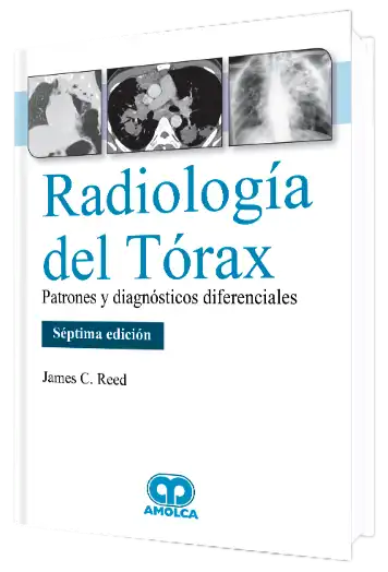 Radiología del Tórax. Patrones y Diagnósticos Diferenciales. 7 edición