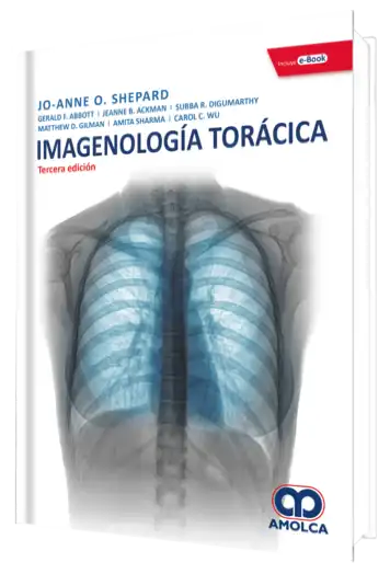 Imagenología Torácica 3 edición