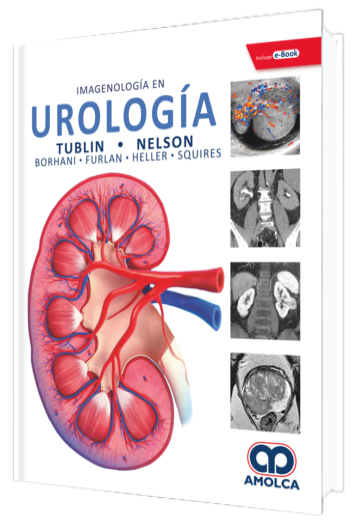 Imagenología en Urología