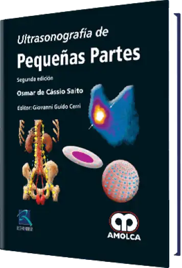 Ultrasonografía de Pequeñas Partes. 2 edición