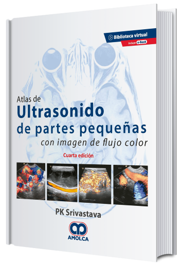 Atlas de Ultrasonido de Partes Pequeñas con Imagen de Flujo Color. 4 Edición