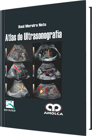 Atlas de Ultrasonografía