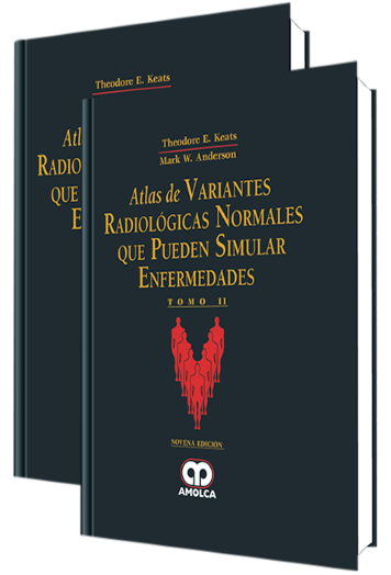 Atlas de Variantes Radiológicas Normales que Pueden Simular Enfermedades. 9 Edición