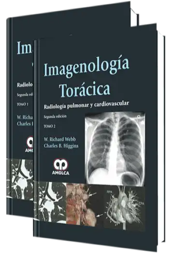 Imagenología Torácica.  Radiología Pulmonar y Cardiovascular 2 edición