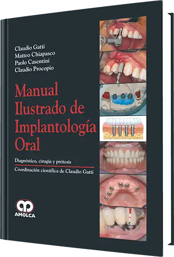 Manual Ilustrado de Implantología Oral