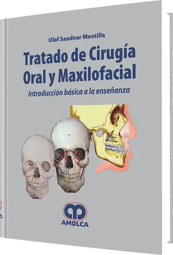 Tratado de Cirugía Oral y Maxilofacial