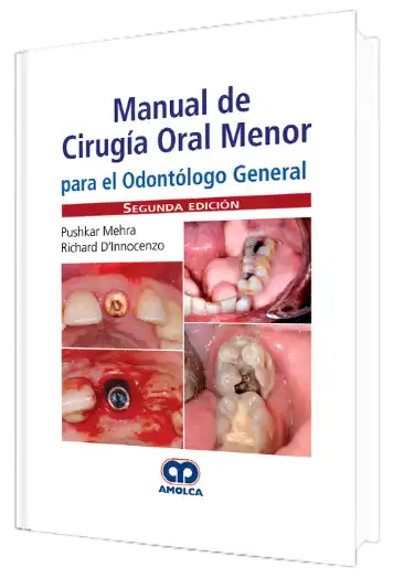 Manual de Cirugía Oral Menor para el Odontólogo General 2 edición