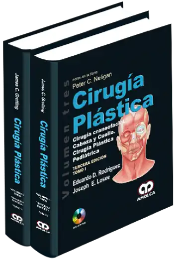 Cirugía Plástica - Cirugía Craneofacial, Cabeza y Cuello. Cirugía Plástica Pediátrica 3 edición, Volumen 3