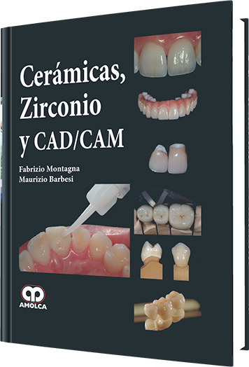 Cerámicas, Zirconio y CAD/CAM