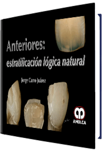 Anteriores: Estratificación Lógica Natural
