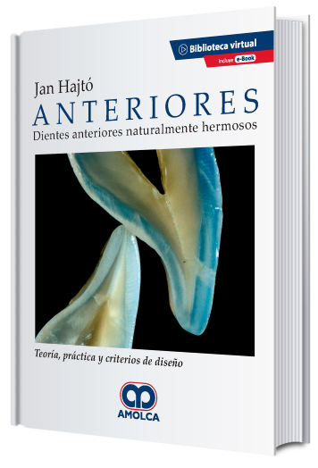 Anteriores. Dientes Anteriores Naturalmente Hermosos. Teoría, Práctica y Criterios de Diseño