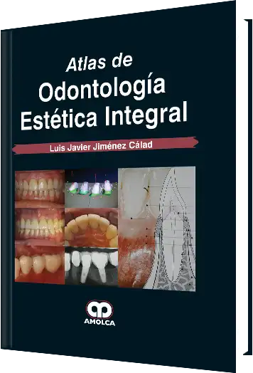 Atlas de Odontología Estética Integral