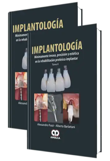 Implantología
