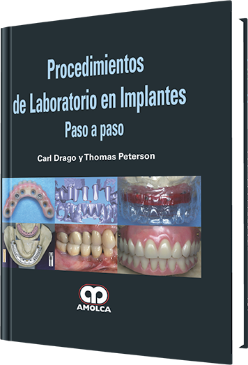 Procedimientos de Laboratorio en Implantes Paso a Paso.