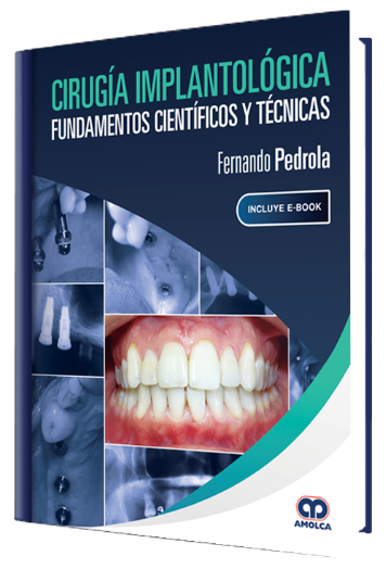 Cirugía Implantológica. Fundamentos Científicos y Técnicas
