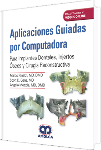 Aplicaciones Guiadas por Computadora