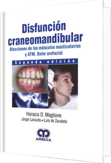 Disfunción Craneomandibular 2 Edición