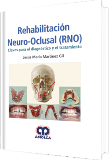 Rehabilitación Neuro-Oclusal (RNO)