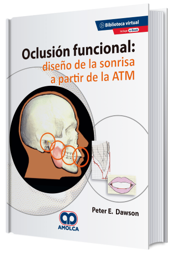 Oclusión Funcional: Diseño de la Sonrisa a Partir de la ATM