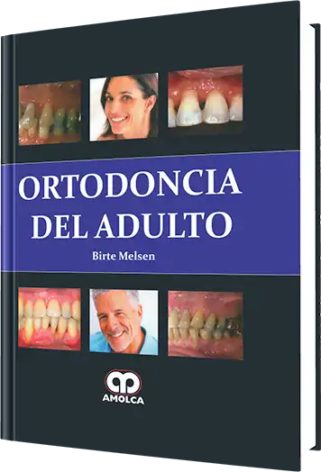 Ortodoncia del Adulto