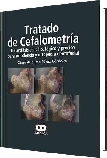 Tratado de Cefalometría