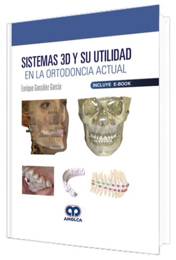 Sistemas 3D y su Utilidad en la Ortodoncia Actual