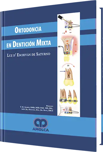 Ortodoncia en la Dentición Mixta