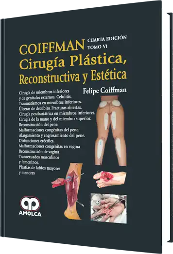 Cirugía Plástica, Reconstructiva y Estética. Cirugía de Miembros Inferiores y de Genitales Externos. 4 edición, Tomo 6