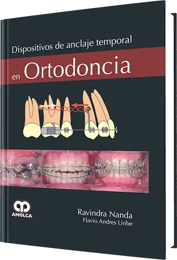Dispositivos de Anclaje Temporal en Ortodoncia