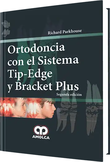 Ortodoncia con el Sistema Tip-Edge y Bracket Plus. 2 edición