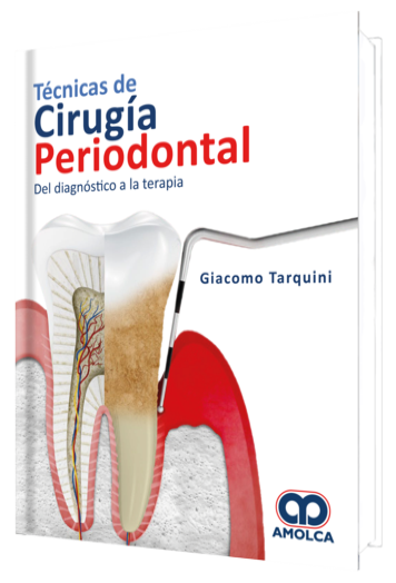 Técnicas de Cirugía Periodontal del Diagnóstico a la Terapia