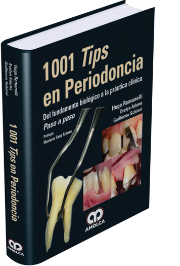 1001 Tips en Periodoncia