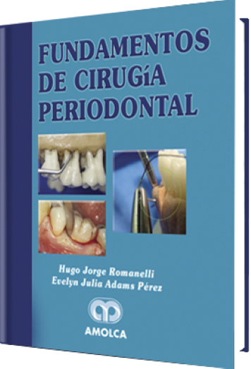 Fundamentos de Cirugía Periodontal
