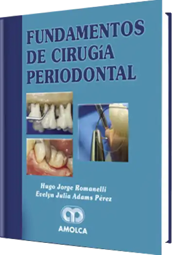 Fundamentos de Cirugía Periodontal