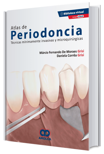 Atlas de Periodoncia