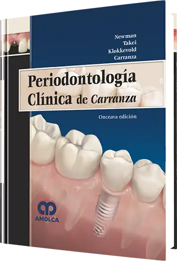 Periodontología Clínica de Carranza. 11 Edición