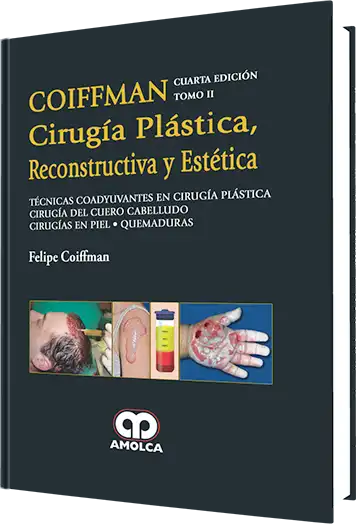 Cirugía Plástica , Reconstructiva y Estética – Técnicas Coadyuvantes, 4 edición, Tomo II