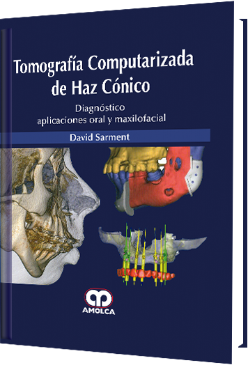 Tomografía Computarizada de Haz Cónico