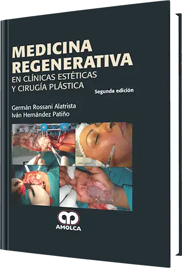 Medicina Regenerativa en Clínicas Estéticas y Cirugía Plástica 2 edición