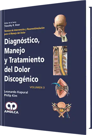 Diagnóstico, Manejo y Tratamiento del Dolor Discogénico Volumen 3