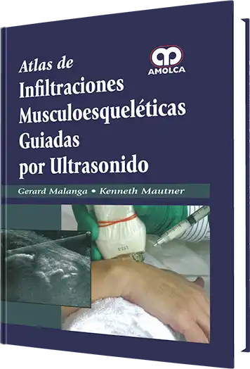 Atlas de Infiltraciones Musculoesqueléticas Guiadas por Ultrasonido