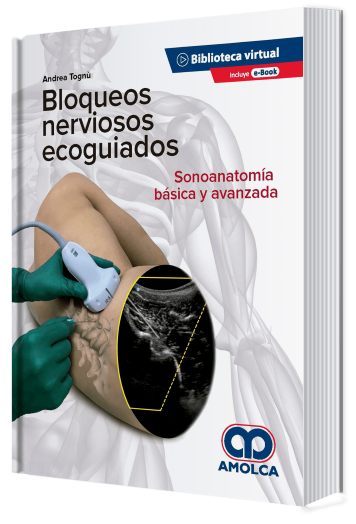 Bloqueos Nerviosos Ecoguiados. Sonoanatomía Básica y Avanzada